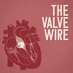 The Valve Wire